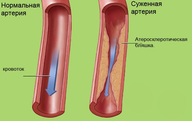 сосуды